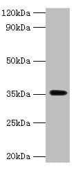 DOK5 Antibody