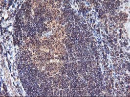 FGF21 Antibody (clone OTI2F10)