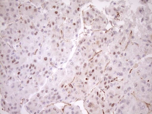 Monoclonal Mouse anti-Human BLNK Antibody (clone OTI4C9, aa1-292, IHC, WB)