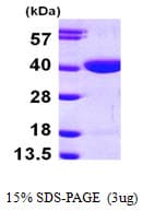 Human RBKS / Ribokinase Protein (Recombinant His)