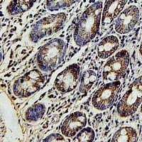 FBXL5 / FBL5 Antibody