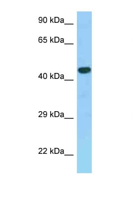 GPER1 / GPR30 Antibody (aa276-325)