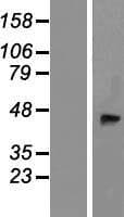 B4GALT2 Protein (Over-Expression Lysate Myc-DDK (Flag))