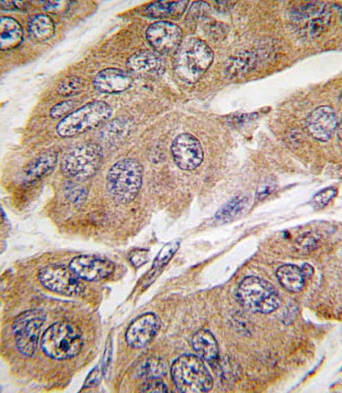 RPS6KB1 / P70S6K / S6K Antibody (Ser424)