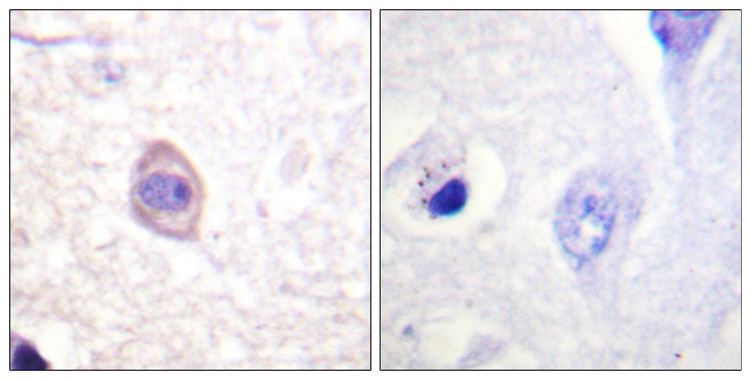 CD119 / IFNGR1 Antibody (phospho-Tyr457)