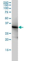 IHC-plus™ LDHB / Lactate Dehydrogenase B Antibody (clone 2H6)