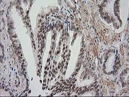 NNMT Antibody (clone OTI1A1)