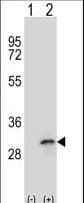SLIM / FHL1 Antibody (aa214-240)