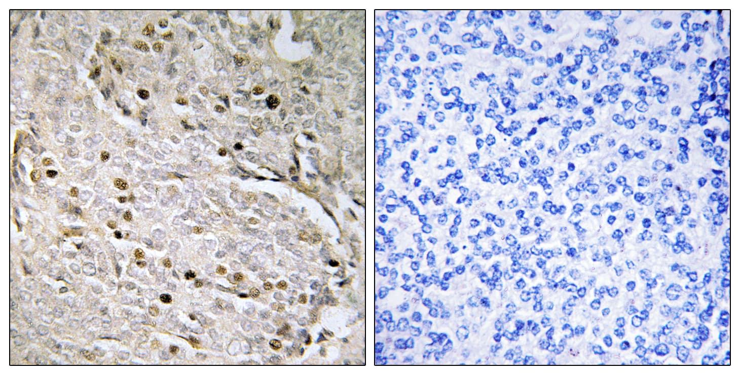 Polyclonal Rabbit anti-Human POTEA / POTE8 Antibody (aa375-424, IHC)