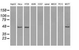 IDH1 / IDH Antibody (clone OTI2H9)