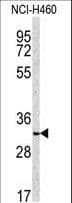 Polyclonal Rabbit anti-Human NQO1 Antibody (aa118-144, IF, WB)