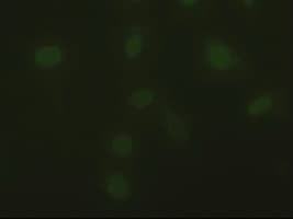 DFFA / ICAD / DFF45 Antibody (clone OTI1B10)