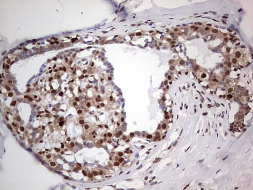 PCNA Antibody (clone OTI13G4)