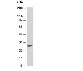 GJB2 / CX26 / Connexin 26 Antibody (aa1-16)