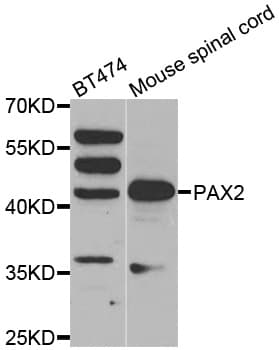 Polyclonal Rabbit anti-Human PAX2 Antibody (IF, WB)