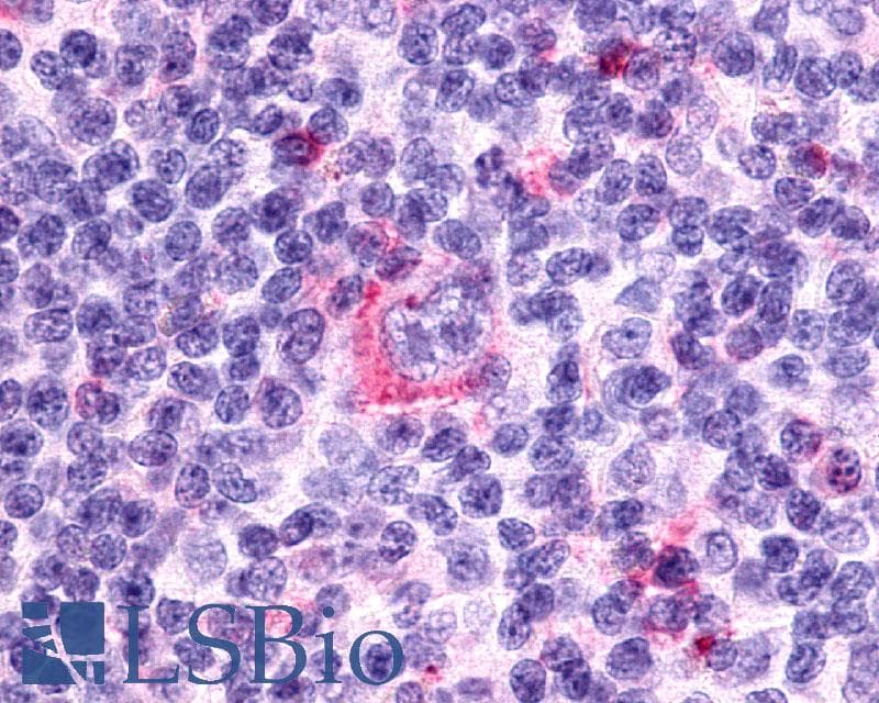 PathPlus™ Polyclonal Rabbit anti-Human CCR7 Antibody (N-Terminus, IHC)