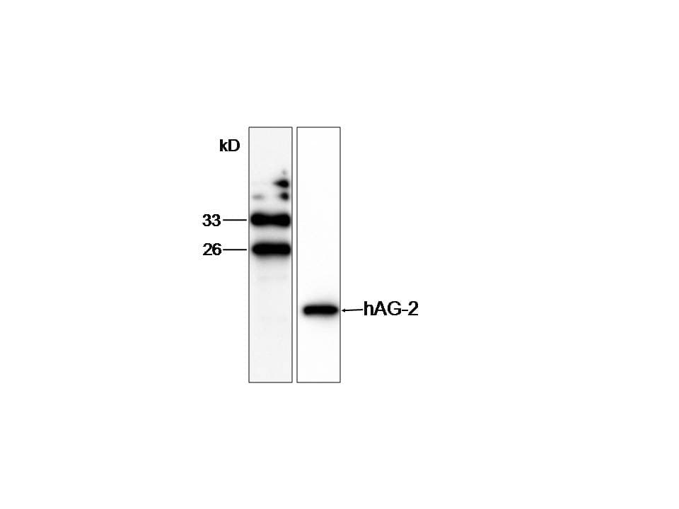 PathPlus™ Monoclonal Mouse anti-Human AGR2 Antibody (aa21-175, IHC, WB)