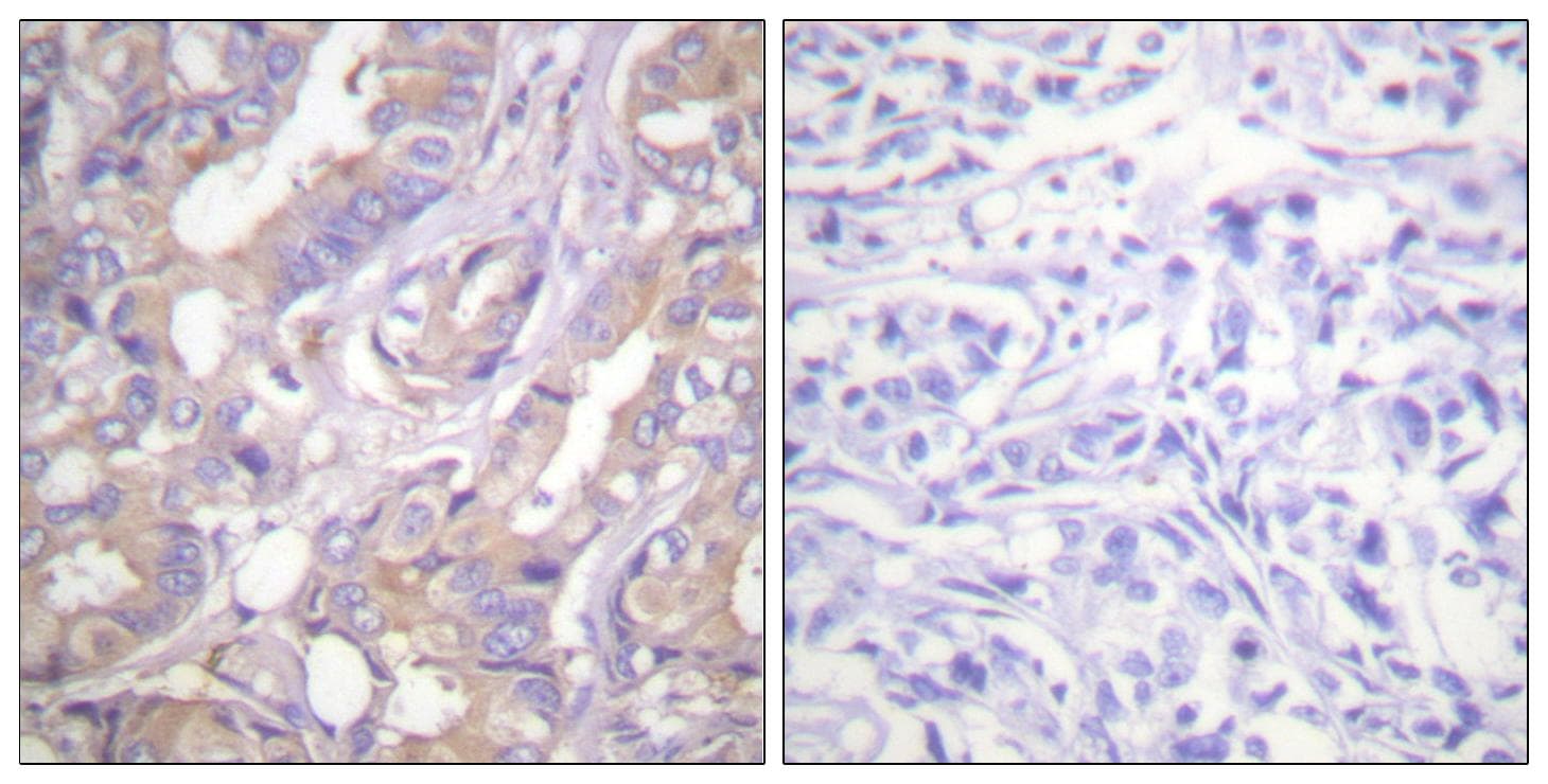 ARAF / ARAF1 / A-RAF Antibody (p301/302)