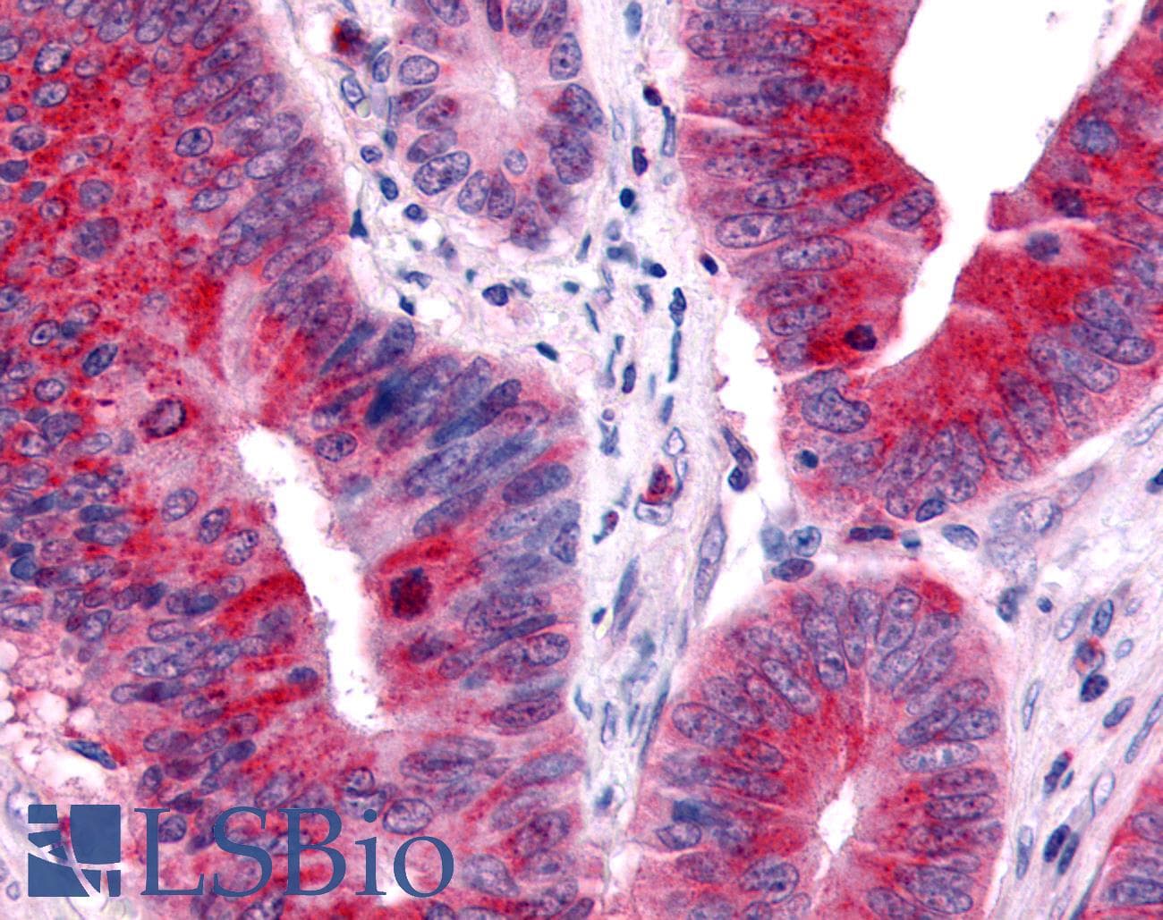 PathPlus™ NR2E1 / TLX Antibody (N-Terminus)
