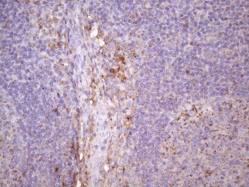 p16INK4a / CDKN2A Antibody (clone OTI2G1)