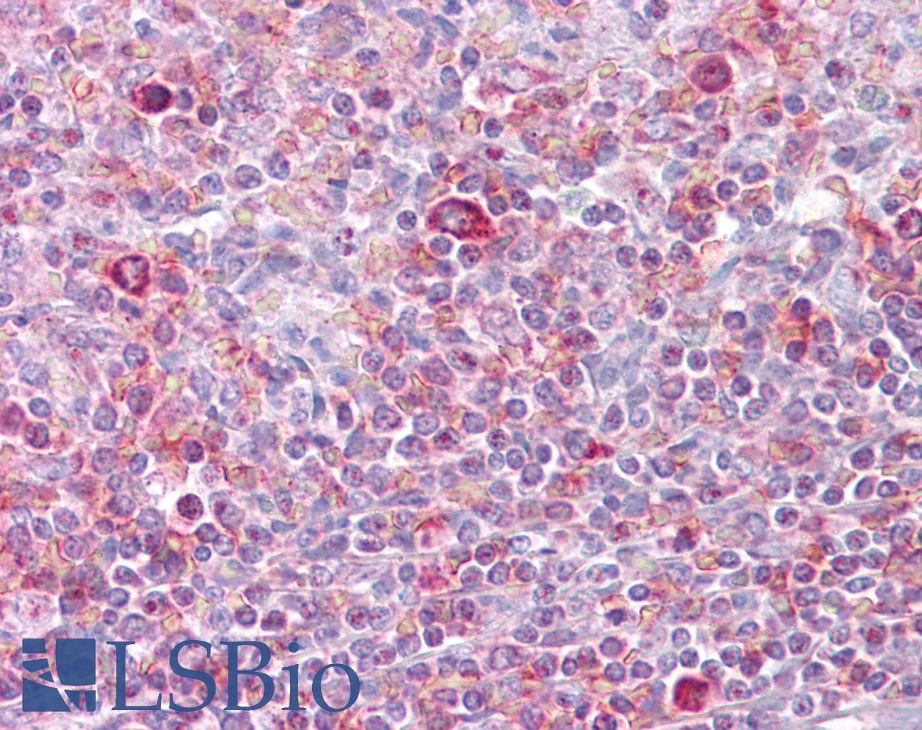 RELB Antibody (N-Terminus)