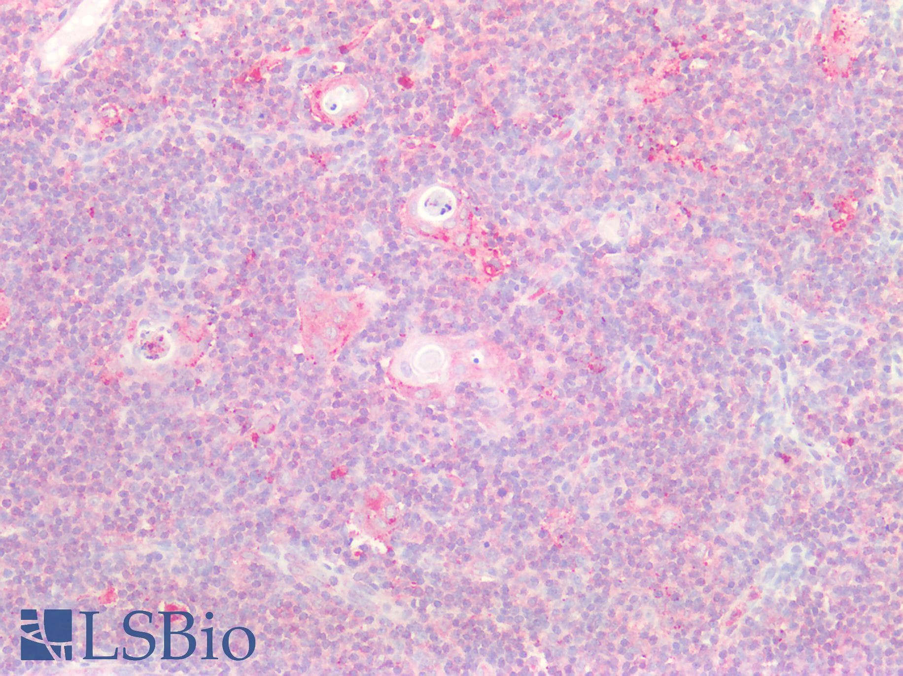 SPTBN4 Antibody (aa64-285)