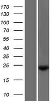 NXNL1 / TXNL6 Protein (Over-Expression Lysate Myc-DDK (Flag))