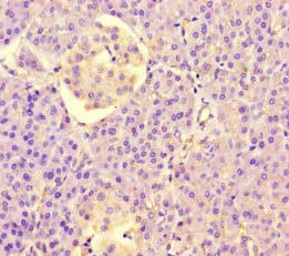 Polyclonal Rabbit anti-Human PPIL5 Antibody (IHC, IF)