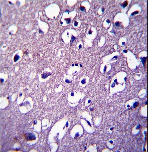 Polyclonal Rabbit anti-Human DCTN4 / Dynactin 4 Antibody (aa1-30, IHC, WB)