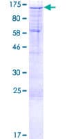 Human SSH1 Protein (Recombinant GST)
