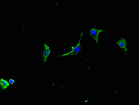 Polyclonal Rabbit anti-Human LZTFL1 Antibody (IHC, IF, WB)