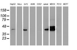 BCAT1 / ECA39 Antibody (clone 3F5, Carrier-free)