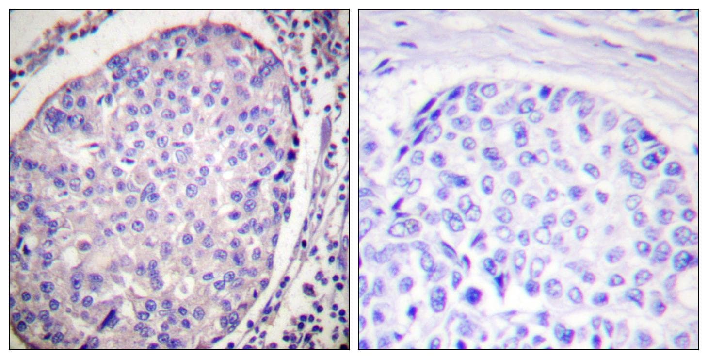 LIPE / HSL Antibody (p554)