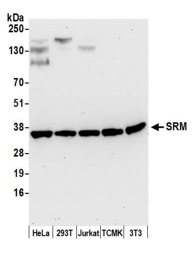 SRM / Spermidine Synthase Antibody (aa100-150)