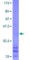Human CHIC2 Protein (Recombinant GST)