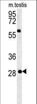 Polyclonal Rabbit anti-Human GSTO2 Antibody (aa82-110, IF, WB)