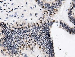 QPRT Antibody (clone OTI4E6)