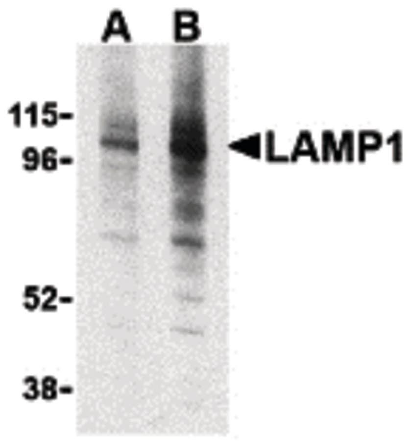 Polyclonal Rabbit anti-Human LAMP1 / CD107a Antibody (IHC, IF, WB)