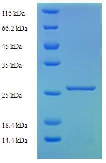 Mouse Murinoglobulin 1 Protein (Recombinant His)