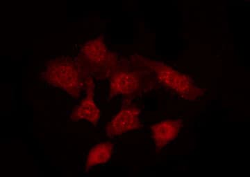 Polyclonal Rabbit anti-Human Acrosin Antibody (IHC, IF, WB)