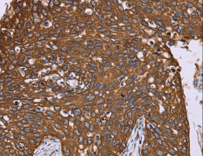 Polyclonal Rabbit anti-Human PPIB / Cyclophilin B Antibody (IHC, WB)