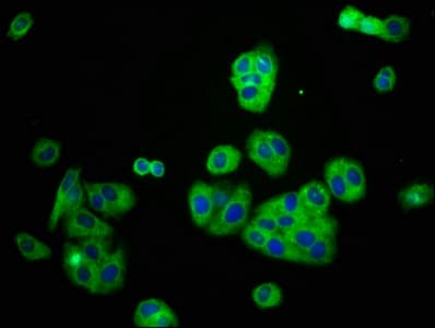 KCNJ8 / Kir6.1 Antibody