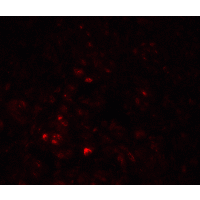Polyclonal Rabbit anti-Human LRRC26 Antibody (IHC, IF, WB)