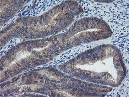 COMMD1 Antibody (clone OTI2D10)