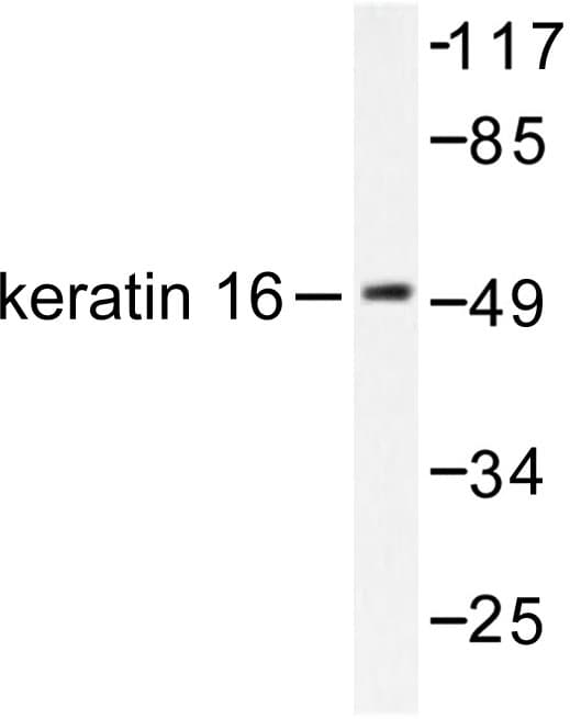 KRT16 / CK16 / Cytokeratin 16 Antibody (Ser451)