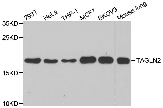 TAGLN2 / Transgelin 2 Antibody