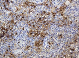 TP / Thymidine Phosphorylase Antibody (clone OTI4F4)