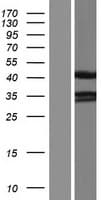 PDLIM2 / SLIM Protein (Over-Expression Lysate Myc-DDK (Flag))