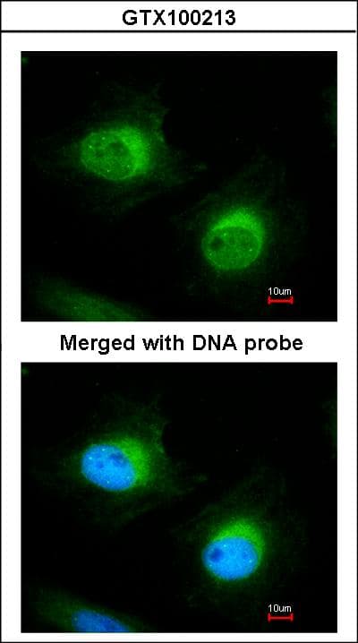 CFL2 / Cofilin 2 Antibody (aa92-166)