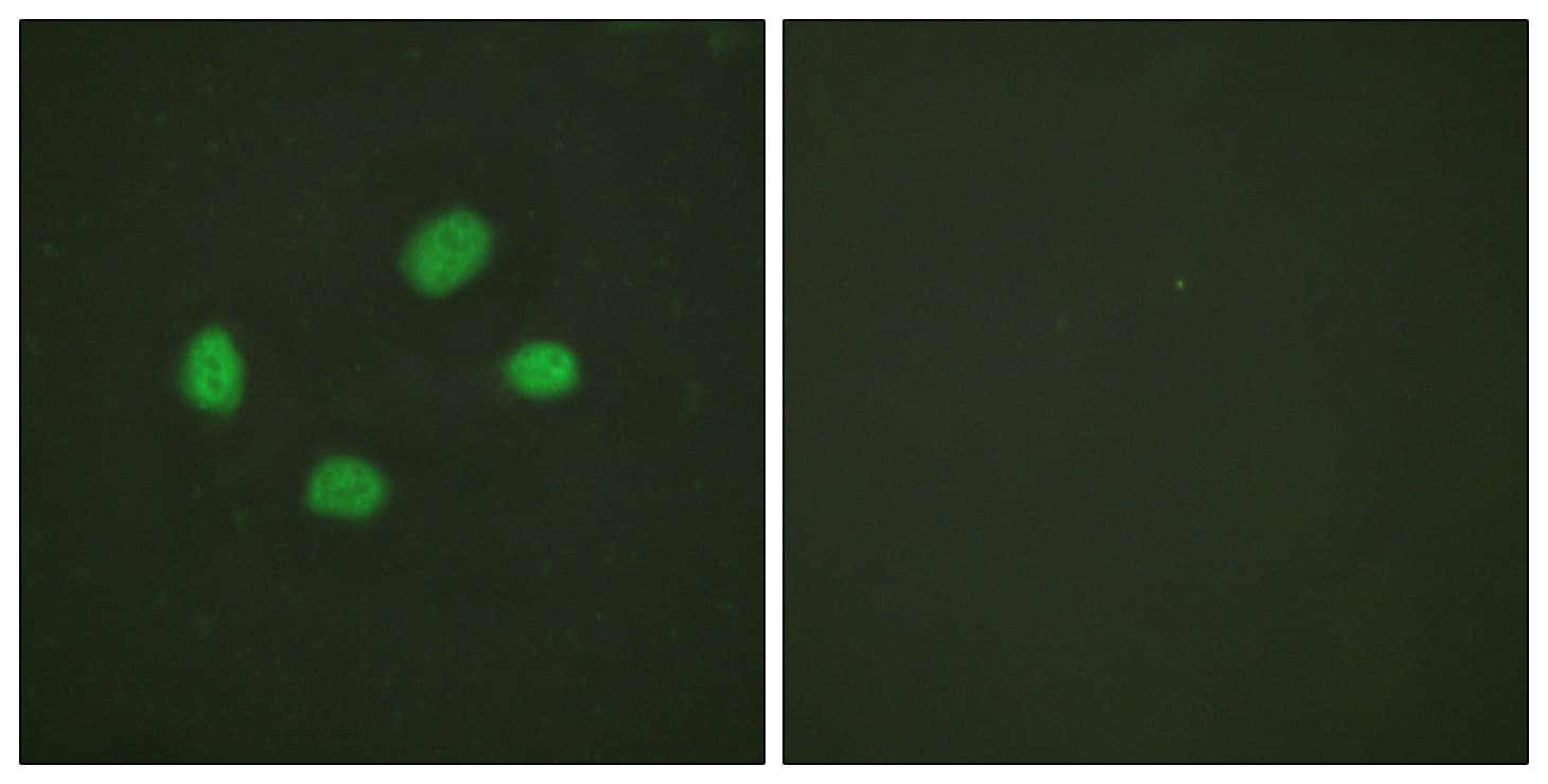 Polyclonal Rabbit anti-Human CHEK2 / CHK2 Antibody (phospho-Thr383, IF, WB)